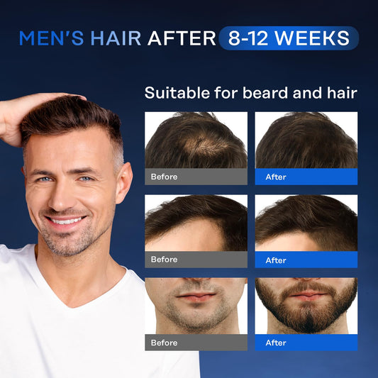 Suero De Crecimiento Capilar- CALIDAD